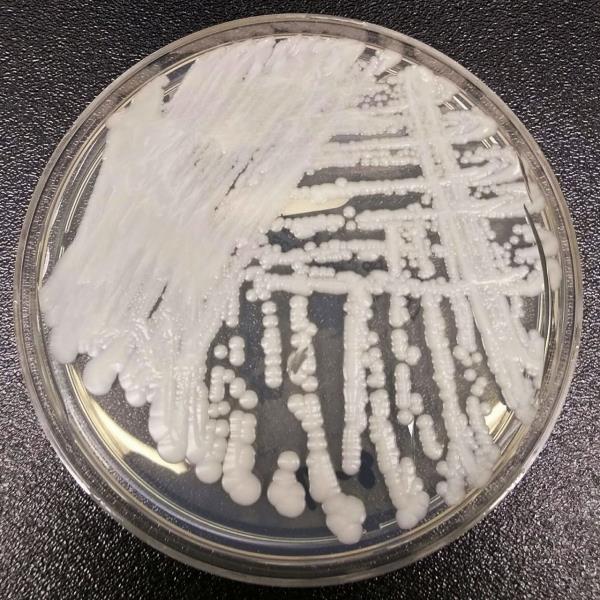 致命的真菌疾病念珠菌以“惊人”的速度传播，阿拉巴马州报告了病例