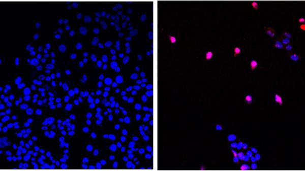 似乎可以“消灭”实体肿瘤的“抗癌药丸”现在正在人体上进行测试