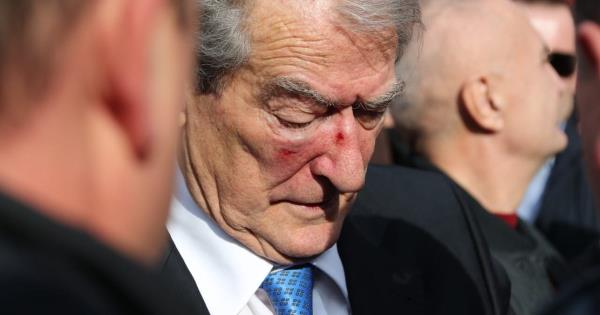 GJKKO对Sali Berisha实施安全措施，他每月两次出现在SPAK，他的护照被封锁，他的行动受到限制，“非女性”回应并威胁不申请