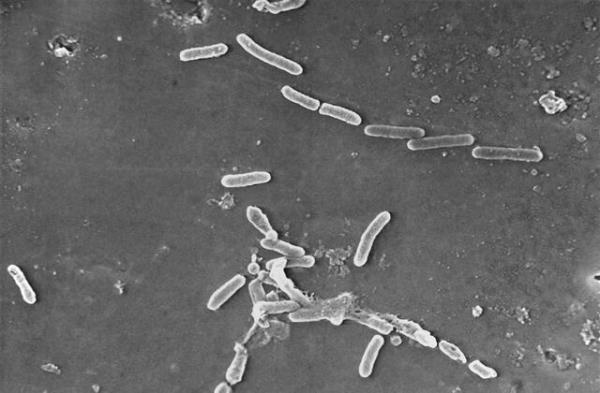召回眼药水导致更多死亡和受伤