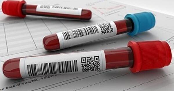 USPSTF重申反对生殖器疱疹筛查的建议
