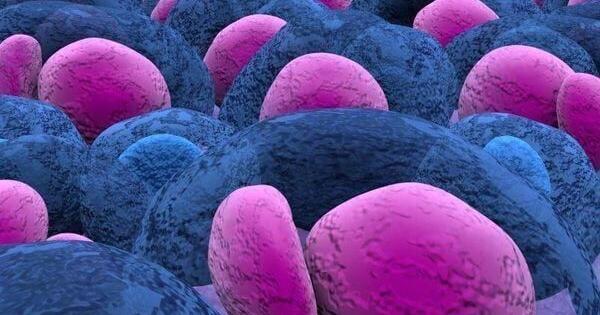 探讨BCMA CAR - T治疗后MM复发的选择