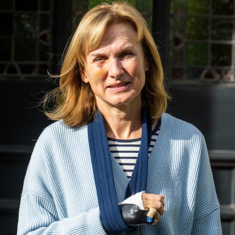 Fiona Bruce addressed her injuries when she introducing the Question Time panel on Thursday night