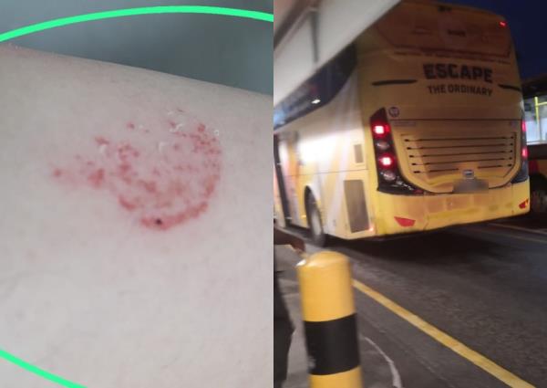 “我很震惊，很痛苦”：捷运司机关上了一名女子的手臂，导致她摔下巴士