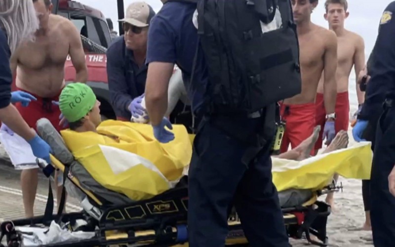 在加利福尼亚州德尔玛附近，游泳者在鲨鱼袭击中通过击打嘴巴逃脱