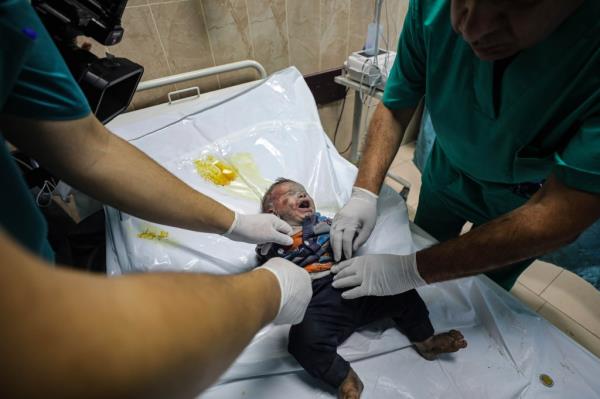 baby injured