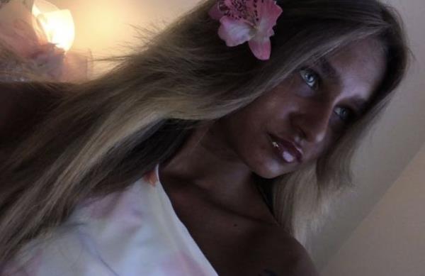 Megan Blain, 18, a student from the UK, obsessed with tanning in sun beds. 