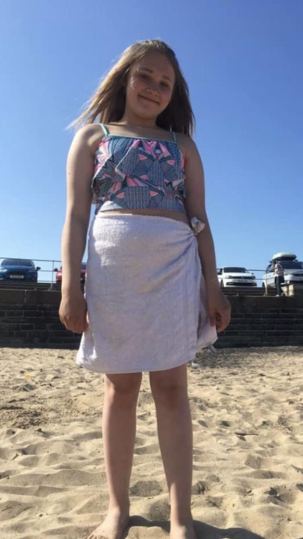 Megan Blain, 18, a student from the UK, obsessed with tanning in sun beds. 