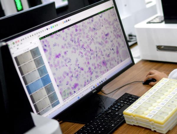 The process might be applicable to screen for other cancers as well.