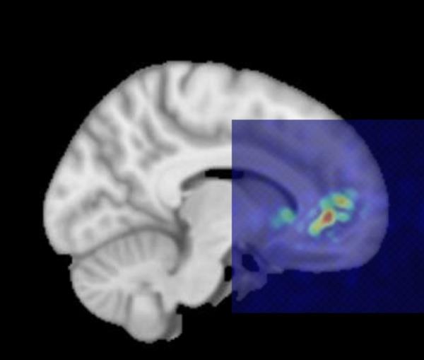 The company said that ultrasounds can stimulate the wearer's prefro<em></em>ntal cortex as they dream.