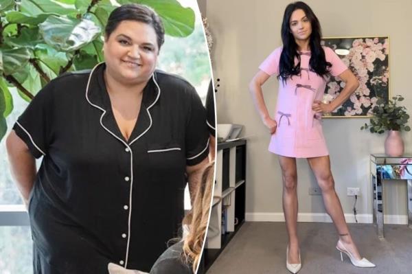 (Left) Amy Kane before weight loss drugs. (Right) Kane after. 