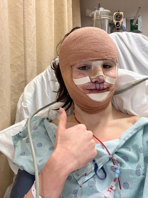 A transgender woman in a hospital bed with bandages covering her face and stitches over her upper lip