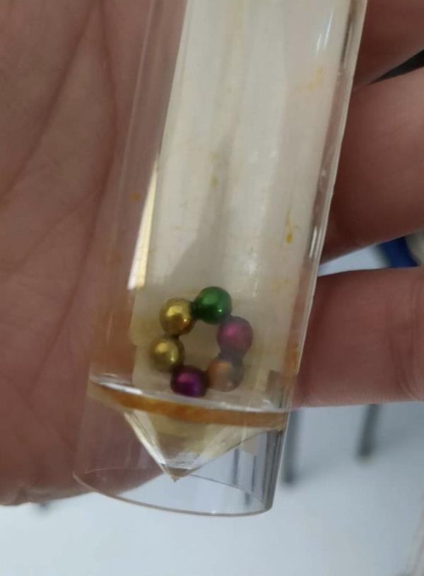 Tiny magnets from stomach