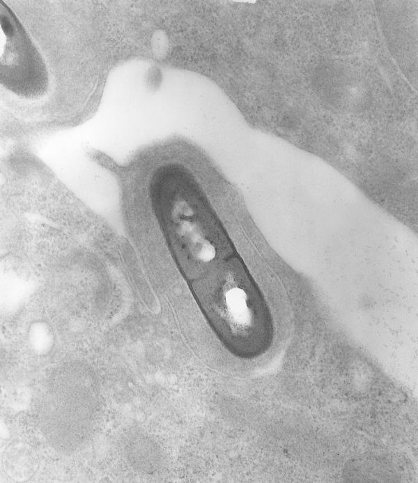 This is a transmission electron micrograph (TEM) of a Listeria sp bacterium in a tissue sample, 2002.