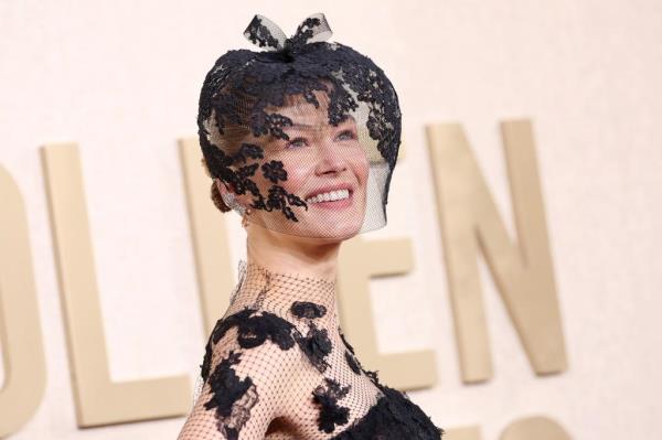 Rosamund Pike reveals she 'smashed up' her face in skiing accident ahead of Golden Globes 2024