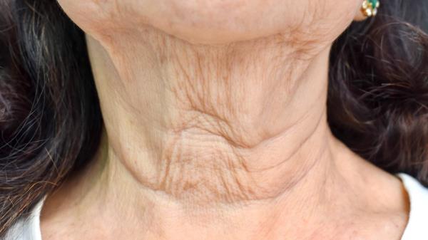 I buy a can for a week. It's green gold for a wrinkled neck. You'll get rid of the 